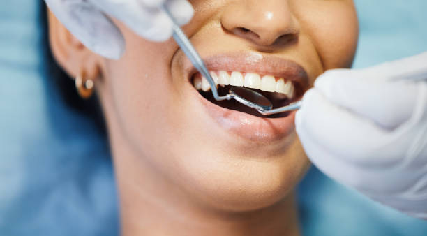 Best Urgent Tooth Repair  in Corry, PA